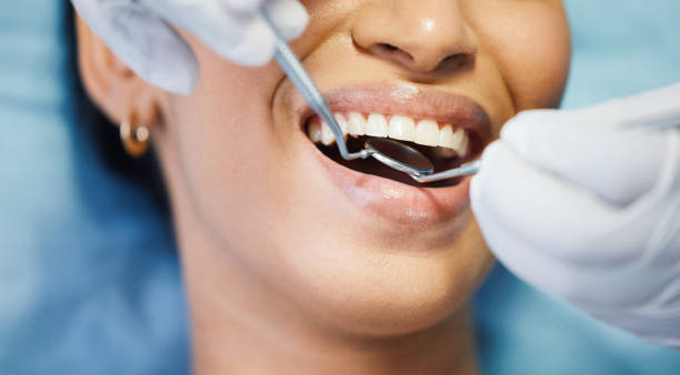 Best Emergency Dental Care for Trauma or Injury in Woodside, CA